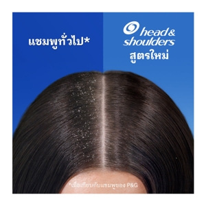 เฮดแอนด์โชว์เดอร์ แชมพูขจัดรังแค สูตรอินสแตนท์ ออยล์ คอนโทรล 370 มล._3