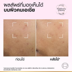 ลอรีอัล ปารีส ไกลโคลิค-ไบรท์ แอนไท-ดาร์ก สปอต เอ็กซ์โฟเลียนท์ พีล 25 มล._thumbnail_7