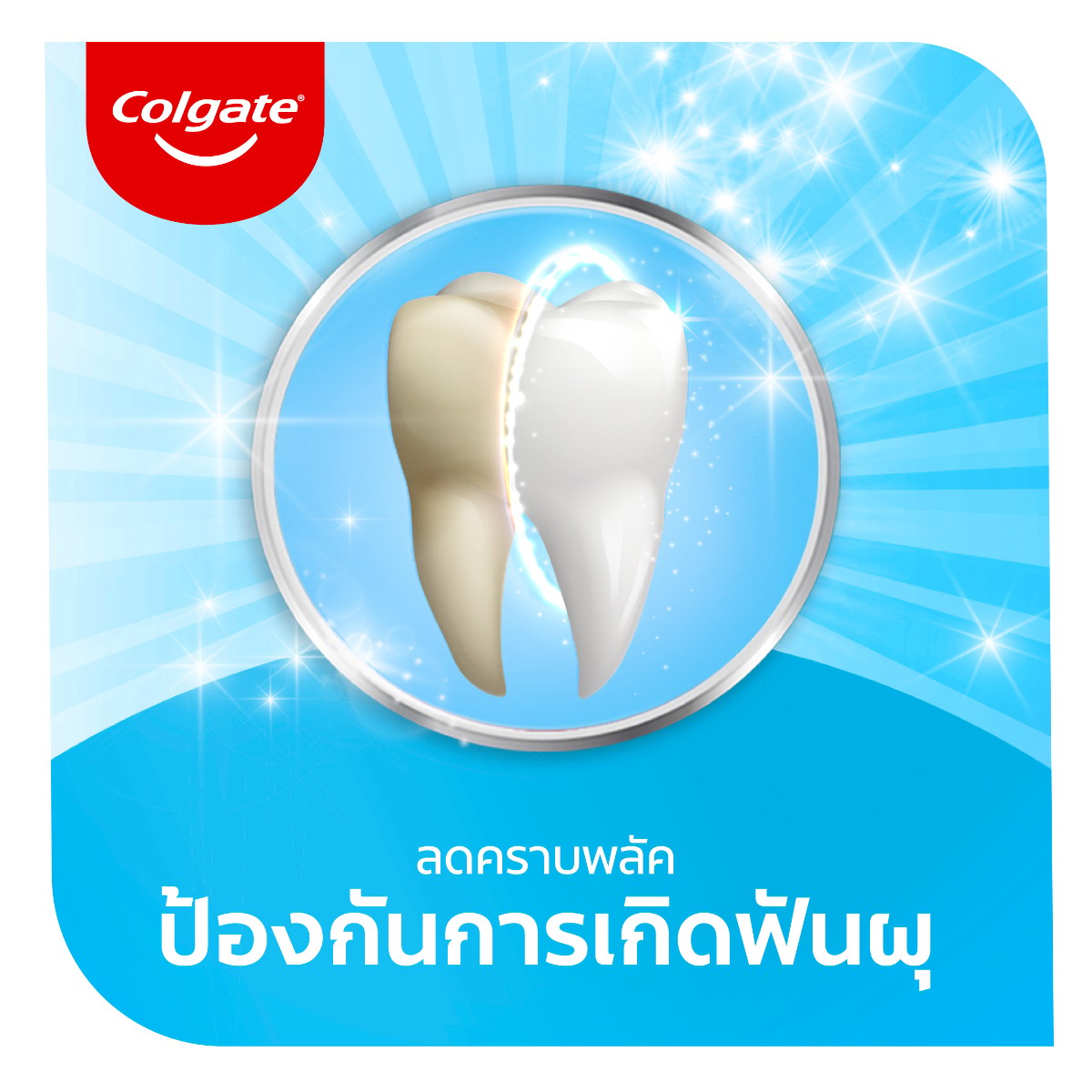 คอลเกต ยาสีฟัน สูตรแอดวานส์ ไวท์เทนนิ่ง 135 ก._1
